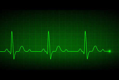 ekg