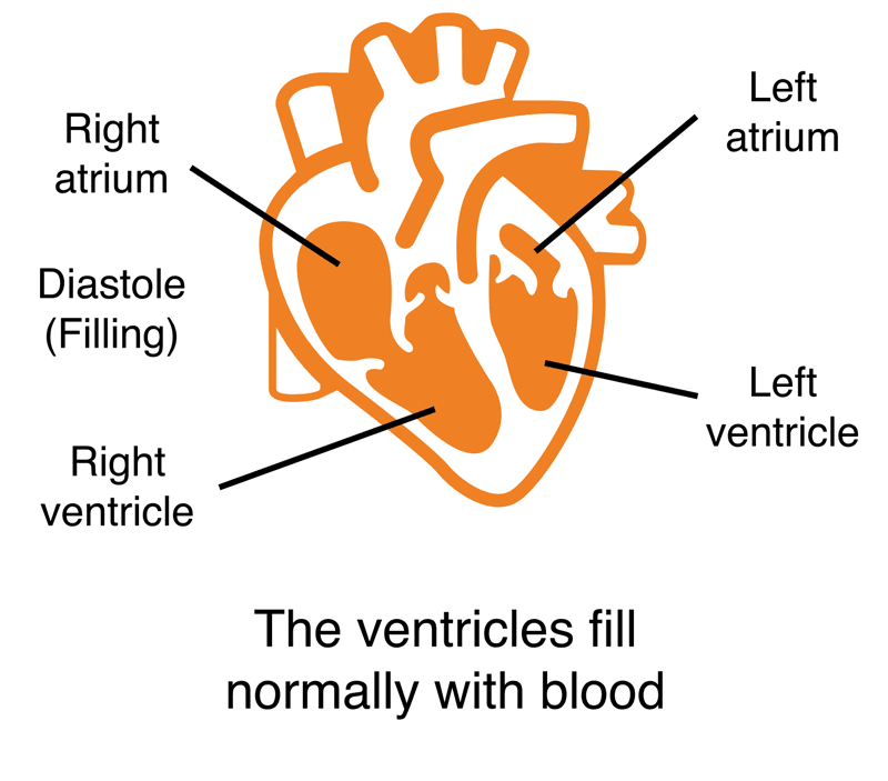 heart